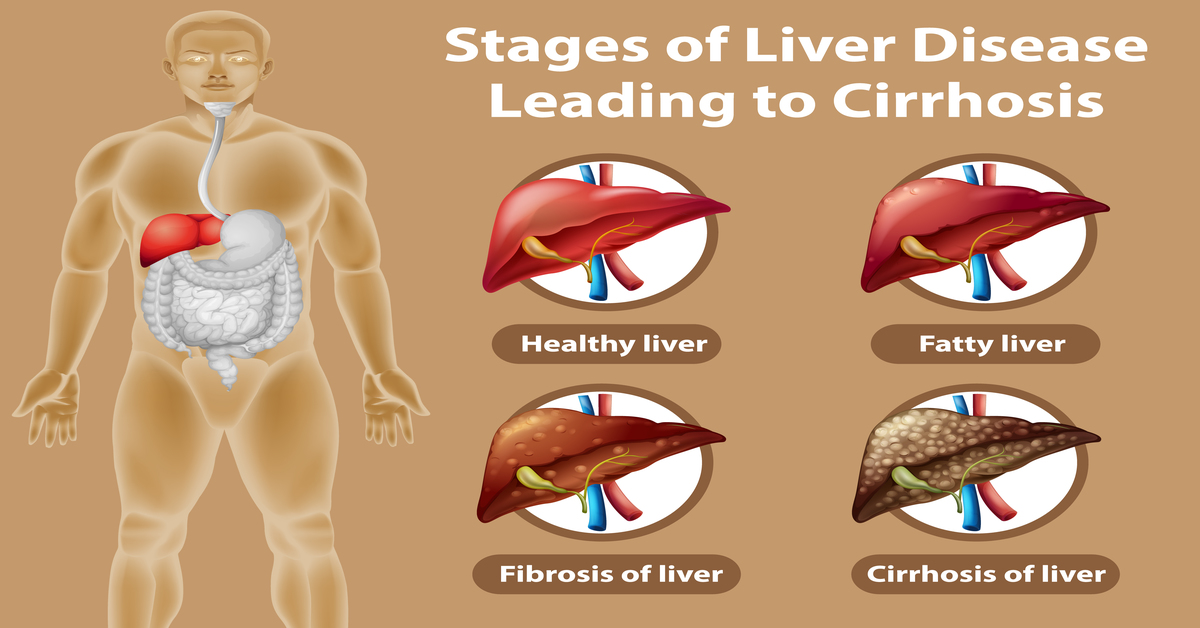 Liver Disease
