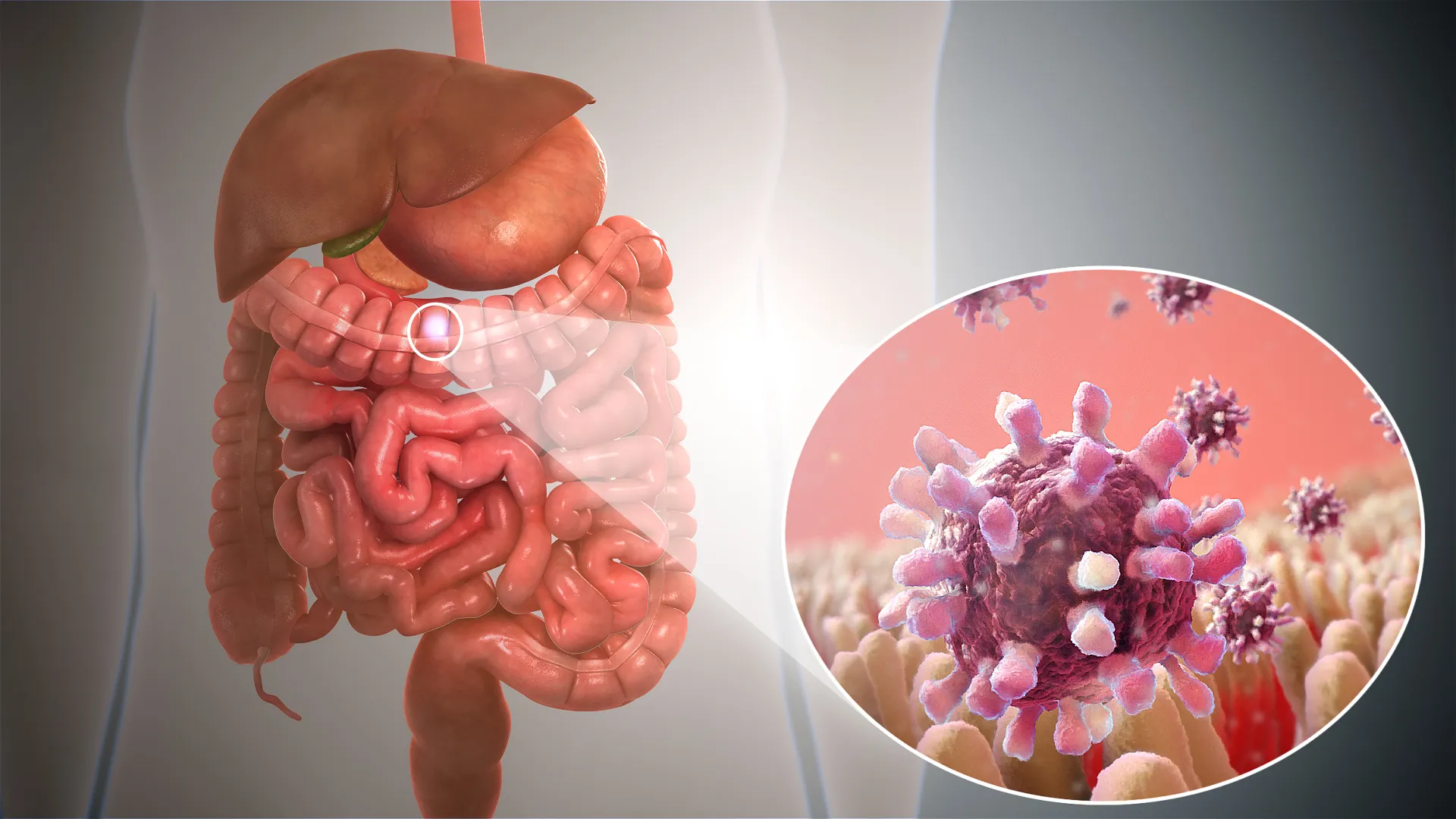 Gastrointestinal Disease345